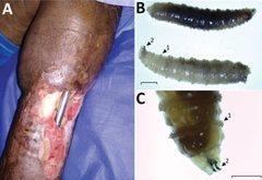 Screwworm Fly unhealed wound18-1053-F1 by Various. Used under a Public domain license.
