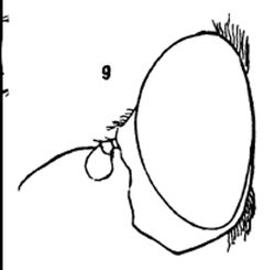 Pterallastes thoracicus male by Williston S.W.. Used under a Public domain license.