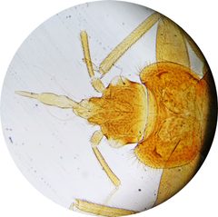 Cimex lectularius Caput by Danny S.. Used under a CC BY-SA 4.0 license.