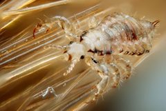 Male human head louse by Gilles San Martin. Used under a CC BY-SA 2.0 license.