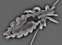 Pediculus Humanus capitis by MaxNikon ( Massimo Brizzi 2020). Used under a CC BY-SA 4.0 license.