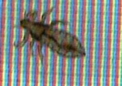 Pediculus humanus capitis 1200190 by Nevit Dilmen (talk). Used under a CC BY-SA 3.0 license.