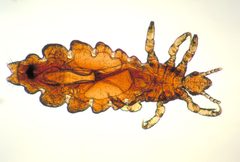 Pediculus humanus capitis CDC0377 by wikipedia. Used under a Public domain license.