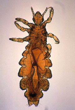 Pediculus humanus var capitis female2 by The original uploader was M123 at English Wikipedia..  Portrait orientation and color balance by Noca2plus.. Used under a Public domain license.