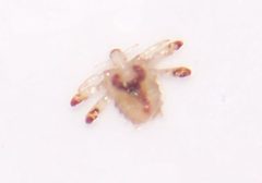 Phthirus pubis 001 by NH2501. Used under a CC BY 2.5 license.