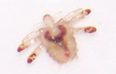 Phthirus pubis B by NH2501. Used under a CC BY 2.5 license.