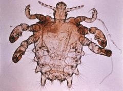 Pthirus pubis - crab louse by wikipedia. Used under a Public domain license.